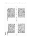 ANTIBODY TARGETING OSTEOCLAST-RELATED PROTEIN Siglec-15 diagram and image