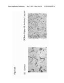 ANTIBODY TARGETING OSTEOCLAST-RELATED PROTEIN Siglec-15 diagram and image