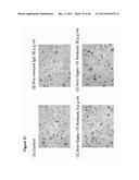 ANTIBODY TARGETING OSTEOCLAST-RELATED PROTEIN Siglec-15 diagram and image