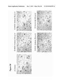 ANTIBODY TARGETING OSTEOCLAST-RELATED PROTEIN Siglec-15 diagram and image