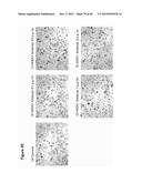 ANTIBODY TARGETING OSTEOCLAST-RELATED PROTEIN Siglec-15 diagram and image