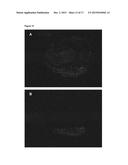 METHODS AND PRODUCT FOR OPTIMISING LOCALISED OR SPATIAL DETECTION OF GENE     EXPRESSION IN A TISSUE SAMPLE diagram and image