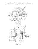 DISSOLVABLE SIEVE, PARTICULATE TOLERANT SYSTEM AND METHOD OF PROTECTING A     TOOL FROM PARTICULATE diagram and image