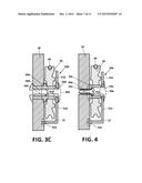 FIXING ASSEMBLY OF A WINDOW REGULATOR PULLEY diagram and image