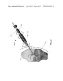 RETROGRADE REAMER DEPTH TUB GAGE diagram and image