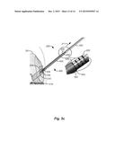 RETROGRADE REAMER DEPTH TUB GAGE diagram and image