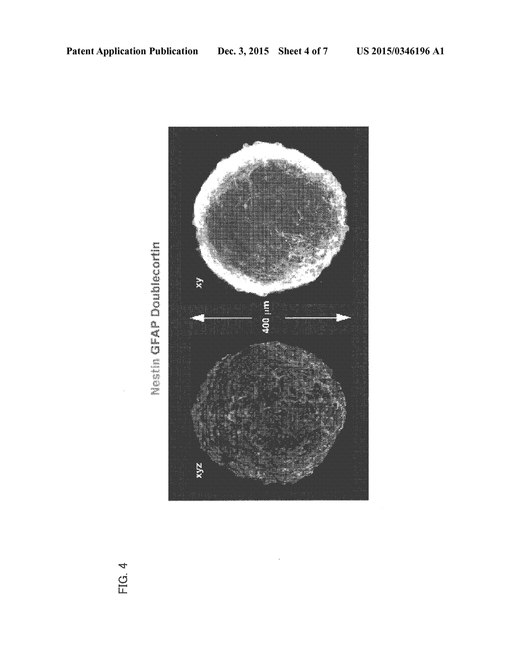 ANTIBODY COMPOSITION, KIT FOR PREPARING ANTIBODY COMPOSITION, AND     IMMUNOSTAINING METHOD - diagram, schematic, and image 05