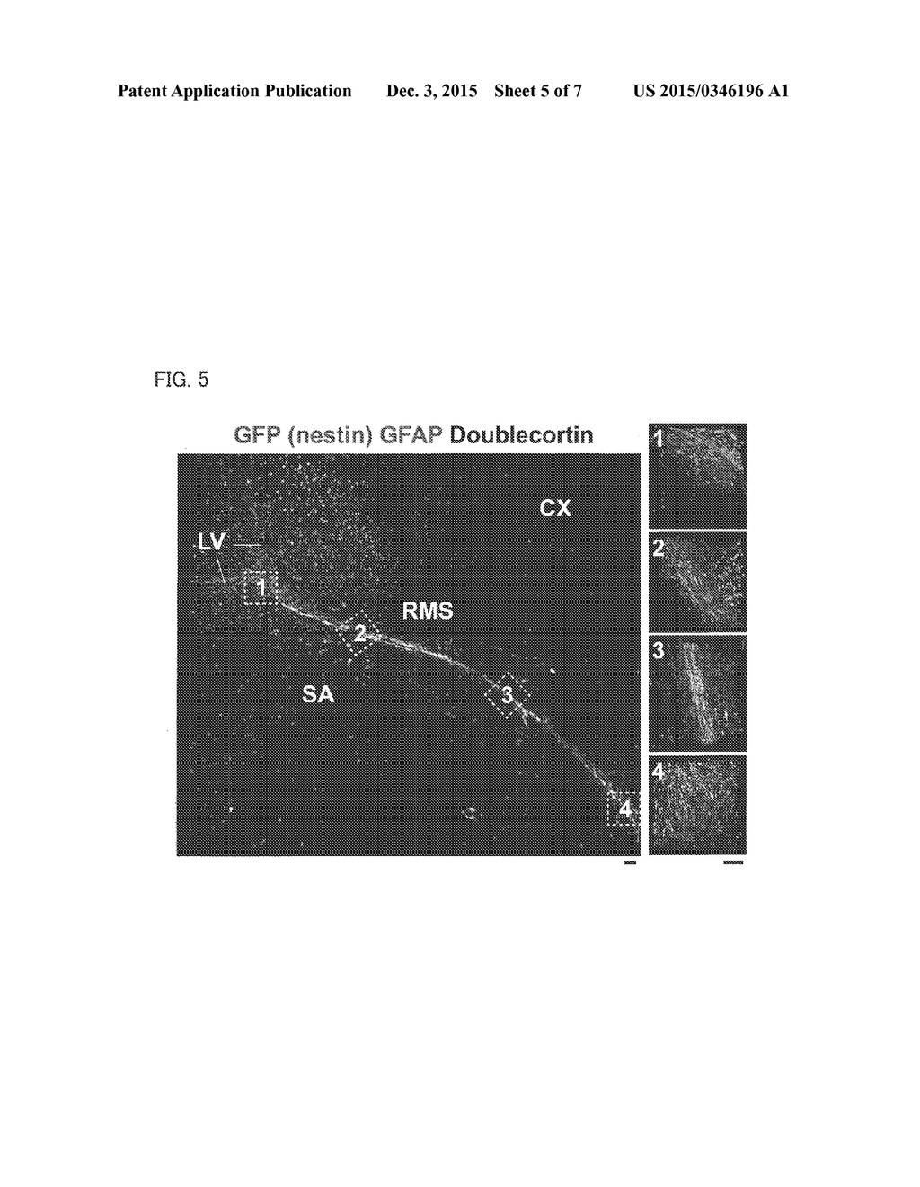 ANTIBODY COMPOSITION, KIT FOR PREPARING ANTIBODY COMPOSITION, AND     IMMUNOSTAINING METHOD - diagram, schematic, and image 06