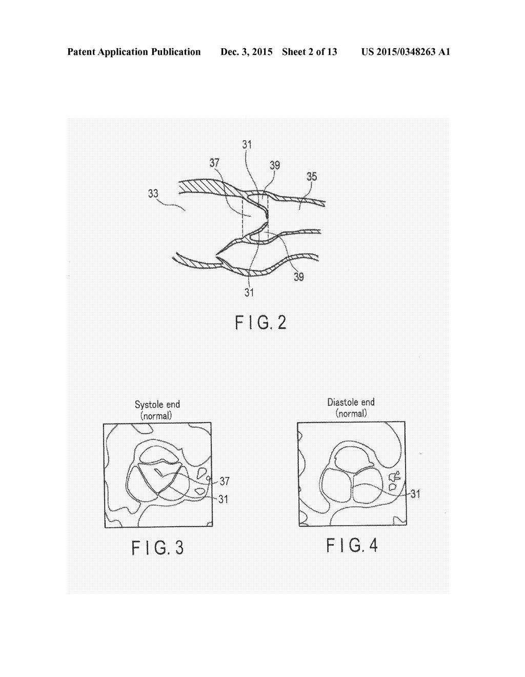 MEDICAL IMAGE PROCESSING APPARATUS AND MEDICAL IMAGE PROCESSING METHOD - diagram, schematic, and image 03