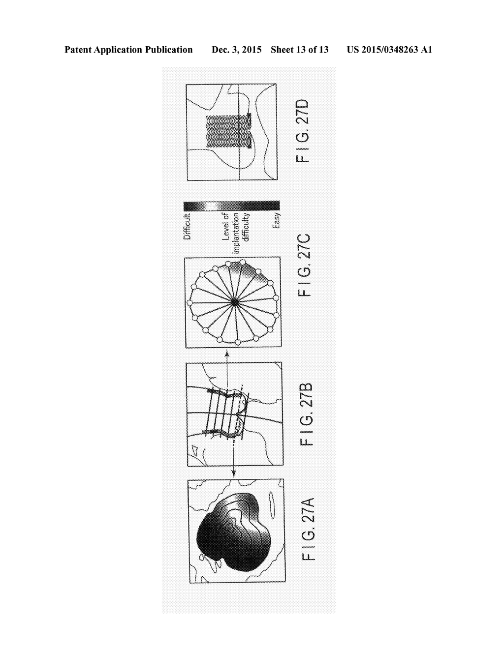 MEDICAL IMAGE PROCESSING APPARATUS AND MEDICAL IMAGE PROCESSING METHOD - diagram, schematic, and image 14