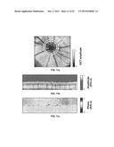 DEVICES, METHODS, AND SYSTEMS OF FUNCTIONAL OPTICAL COHERENCE TOMOGRAPHY diagram and image