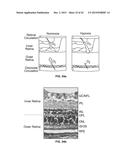 DEVICES, METHODS, AND SYSTEMS OF FUNCTIONAL OPTICAL COHERENCE TOMOGRAPHY diagram and image