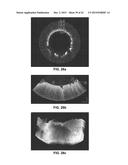 DEVICES, METHODS, AND SYSTEMS OF FUNCTIONAL OPTICAL COHERENCE TOMOGRAPHY diagram and image