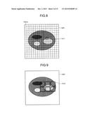 IMAGE PROCESSING DEVICE, RADIATION DETECTING DEVICE, AND IMAGE PROCESSING     METHOD diagram and image