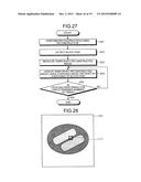 IMAGE PROCESSING DEVICE, RADIATION DETECTING DEVICE, AND IMAGE PROCESSING     METHOD diagram and image