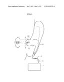 VOLTAGE CONTROL DEVICE FOR EAR MICROPHONE diagram and image