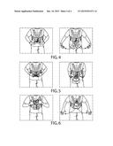 Rapidly Removable Gloves and Related Methods diagram and image