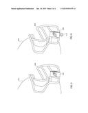 SYSTEM FOR DISPLAYING A GRAPHIC ON A HELMET diagram and image