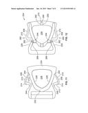 SIDE-RELEASE BUCKLE ASSEMBLY diagram and image