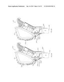 SURFACE CLEANING APPARATUS diagram and image