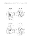 OPHTHALMOLOGIC MEASUREMENT APPARATUS, METHOD AND PROGRAM OF CONTROLLING     THE SAME diagram and image