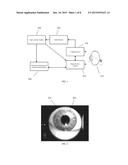 SYSTEMS AND METHODS FOR IMPROVED OPHTHALMIC IMAGING diagram and image