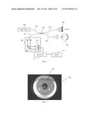 SYSTEMS AND METHODS FOR IMPROVED OPHTHALMIC IMAGING diagram and image