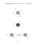 SYSTEMS AND METHODS FOR IMPROVED OPHTHALMIC IMAGING diagram and image