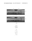 SYSTEMS AND METHODS FOR IMPROVED OPHTHALMIC IMAGING diagram and image