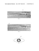 SYSTEMS AND METHODS FOR IMPROVED OPHTHALMIC IMAGING diagram and image