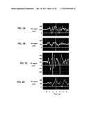 DEVICE AND METHOD FOR IN VIVO NONINVASIVE MAGNETIC MANIPULATION OF     CIRCULATING OBJECTS IN BIOFLOWS diagram and image