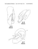 Physiological Monitoring Devices Having Sensing Elements Decoupled from     Body Motion diagram and image