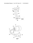 Physiological Monitoring Devices Having Sensing Elements Decoupled from     Body Motion diagram and image