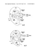 Physiological Monitoring Devices Having Sensing Elements Decoupled from     Body Motion diagram and image