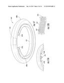 Physiological Monitoring Devices Having Sensing Elements Decoupled from     Body Motion diagram and image