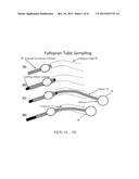 METHODS AND DEVICES FOR FALLOPIAN TUBE DIAGNOSTICS diagram and image