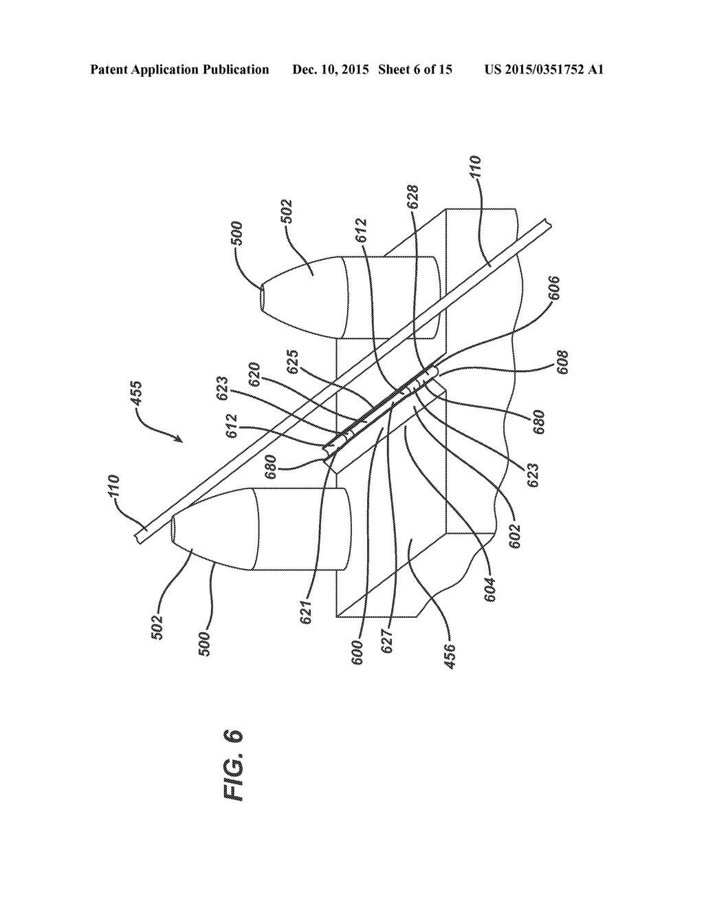 Suture with Trim Formed Tip - diagram, schematic, and image 07