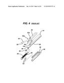 Methods and Devices for Reinforcing a Staple Line diagram and image