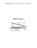 Methods and Devices for Reinforcing a Staple Line diagram and image