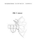 METHODS AND DEVICES FOR SEALING STAPLED TISSUE diagram and image