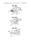 METHODS AND DEVICES FOR SEALING STAPLED TISSUE diagram and image