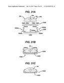 METHODS AND DEVICES FOR SEALING STAPLED TISSUE diagram and image