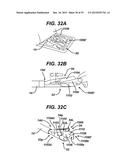 METHODS AND DEVICES FOR SEALING STAPLED TISSUE diagram and image