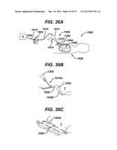 METHODS AND DEVICES FOR SEALING STAPLED TISSUE diagram and image