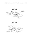 METHODS AND DEVICES FOR SEALING STAPLED TISSUE diagram and image