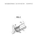 Devices and Methods for Sealing Staples in Tisue diagram and image