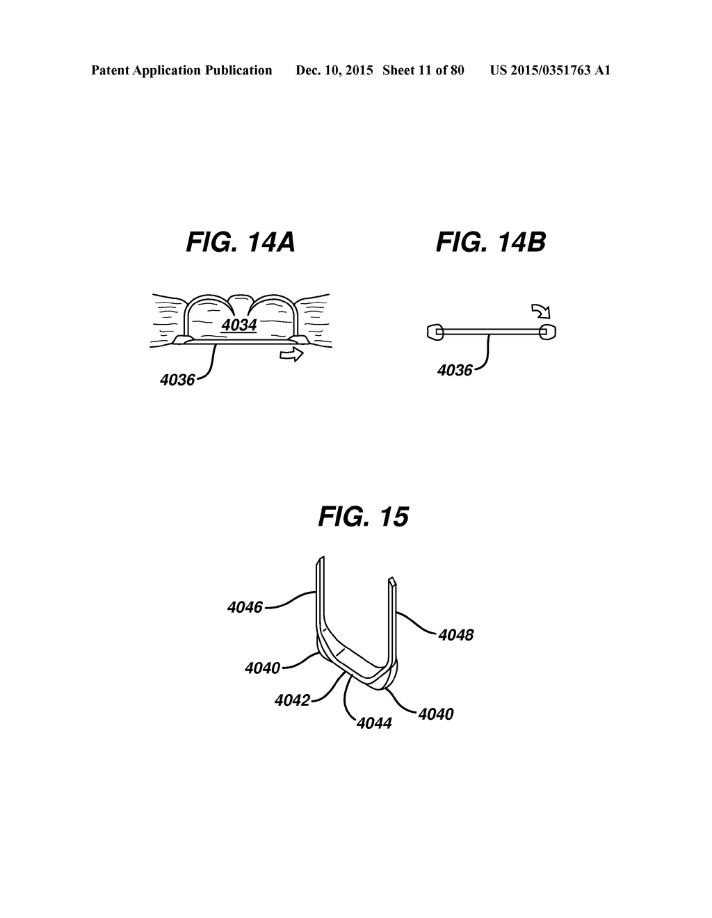 Devices and Methods for Sealing Staples in Tisue - diagram, schematic, and image 12