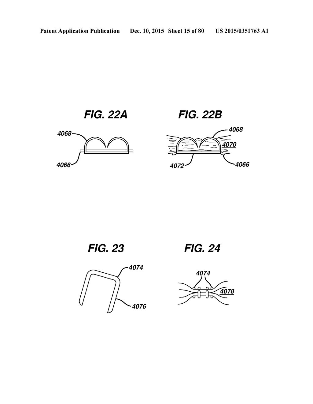 Devices and Methods for Sealing Staples in Tisue - diagram, schematic, and image 16