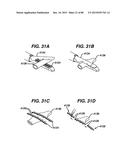 Devices and Methods for Sealing Staples in Tisue diagram and image