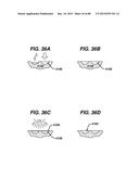 Devices and Methods for Sealing Staples in Tisue diagram and image